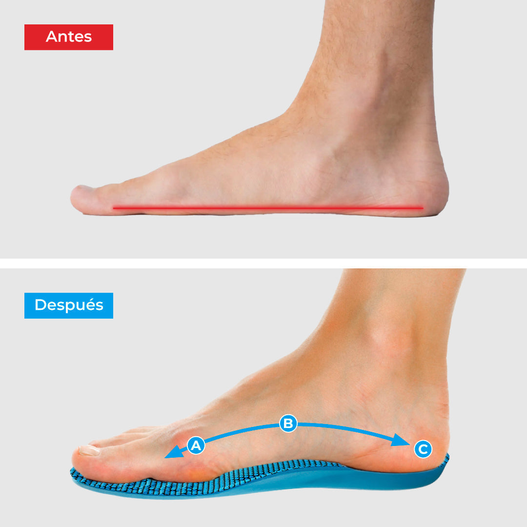 Plantillas Ortopédicas ComfyFeet Ergonómicas Alivio del Dolor Recortables