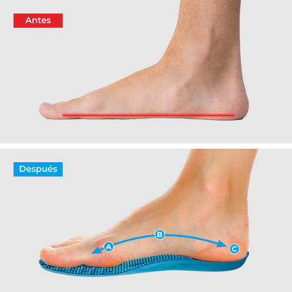 Plantillas Ortopédicas ComfyFeet Ergonómicas Alivio del Dolor Recortables