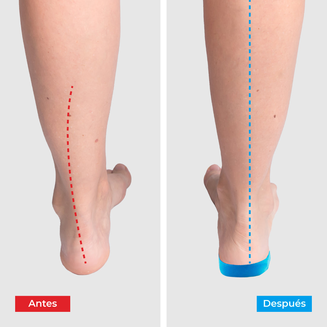 Plantillas Ortopédicas ComfyFeet Ergonómicas Alivio del Dolor Recortables