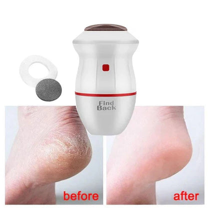 Electric Callus Remover Professional Pedicure Foot File
